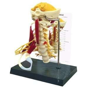 GPI Anatomical Deluxe Muscled Cervical Spine Model  