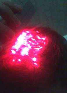 Laser Hair Growth Loss Regrowth Treatment (21x More Power Than Comb 