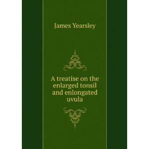   on the enlarged tonsil and enlongated uvula James Yearsley Books