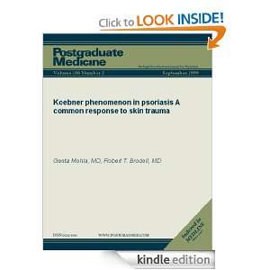 Koebner phenomenon in psoriasis A common response to skin trauma 