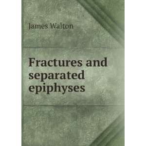  Fractures and separated epiphyses James Walton Books